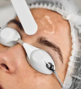 traitement photorajeunissement ipl