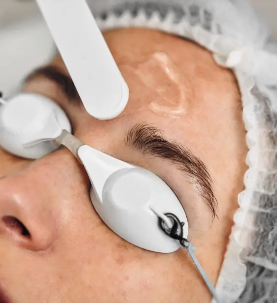 traitement photorajeunissement ipl